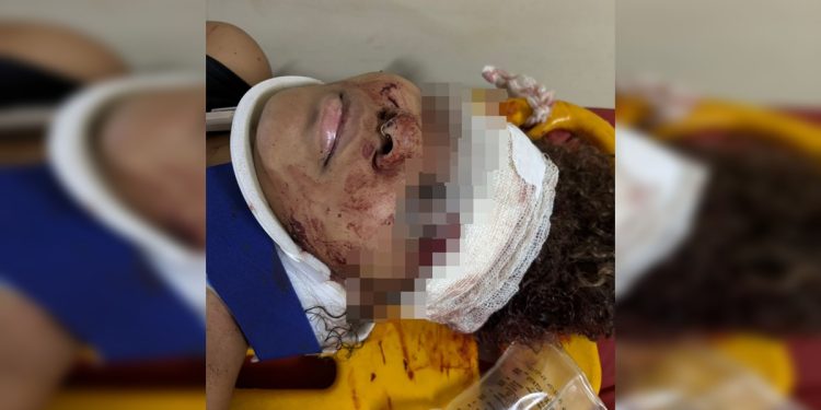 Testemunha gritou para motorista que atropelou jovem parar de dar ré