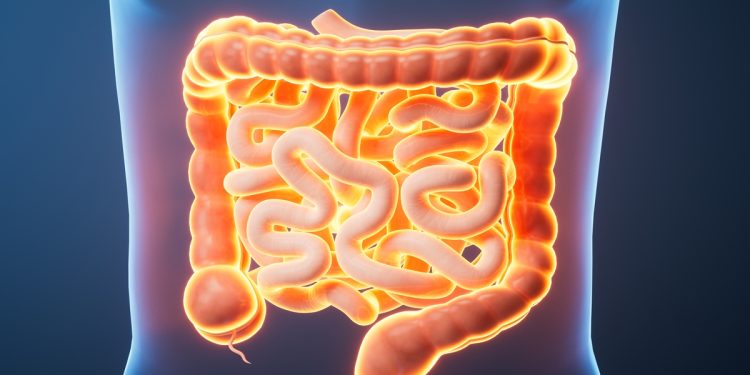 Câncer de intestino: sete sintomas silenciosos que merecem atenção