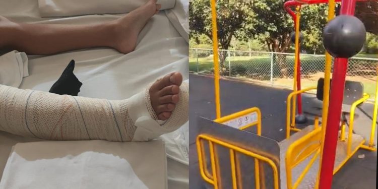 Menina de 9 anos quebra a perna em brinquedo de parque em Águas Claras. Veja vídeo