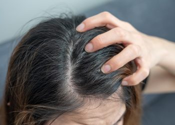 Tomar sol no cabelo ajuda a diminuir a caspa? Entenda se efeito existe