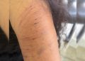 Mulher é atacada pelo ex no meio da rua a caminho de consulta com psicólogo