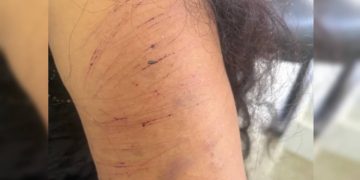 Mulher é atacada pelo ex no meio da rua a caminho de consulta com psicólogo