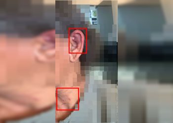 Mulher agredida por amigo do filho desmaiou por estrangulamento