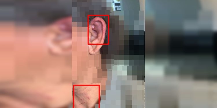 Mulher agredida por amigo do filho desmaiou por estrangulamento