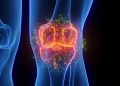 Estudo testa injeção que pode reverter osteoartrite
