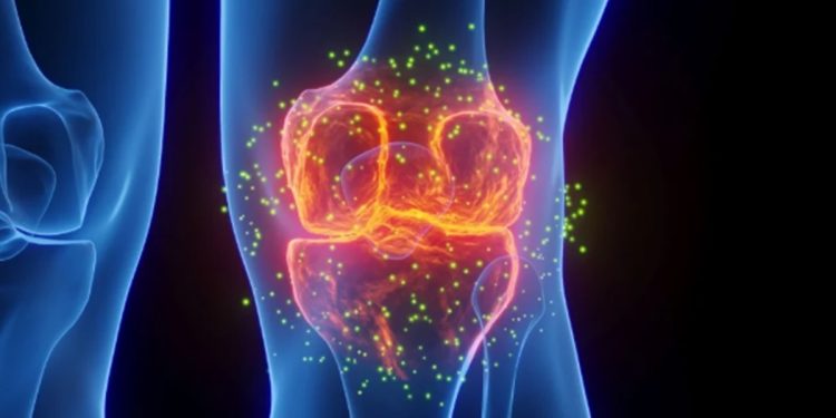 Estudo testa injeção que pode reverter osteoartrite
