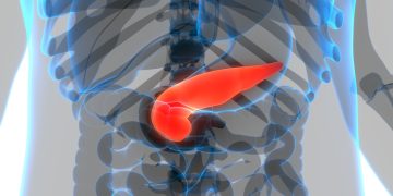 IA identifica sinais de câncer de pâncreas anos antes do diagnóstico