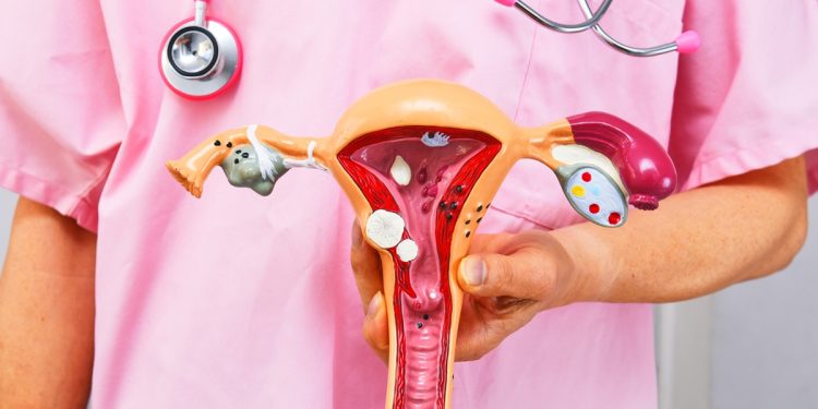 Endometriose: 4 em cada 10 mulheres não sabem sobre a condição