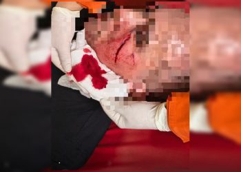 PM é atacado com telha durante ocorrência de violência doméstica