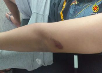 Trio de adolescentes dá rasteira, socos e rouba menino de 15 anos