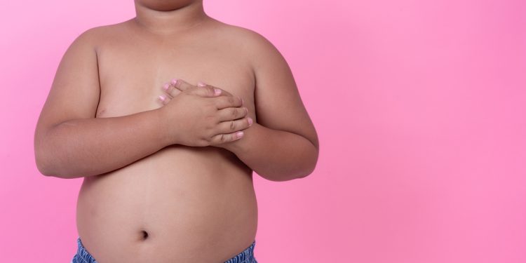 Sem controle, obesidade na infância tende a se manter na adolescência