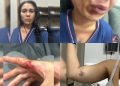 Juiz diz que mulher esganada não sofreu tentativa de feminicídio, “apenas” violência doméstica