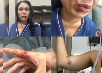Juiz diz que mulher esganada não sofreu tentativa de feminicídio, “apenas” violência doméstica