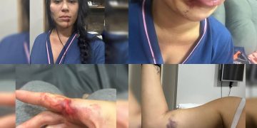 Juiz diz que mulher esganada não sofreu tentativa de feminicídio, “apenas” violência doméstica