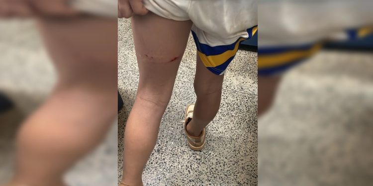 Mãe denuncia que filho teria sido agredido por professora em escola na Asa Norte