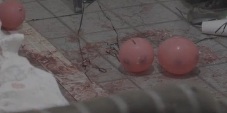 Bolo e sangue: aniversariante é esfaqueado por esposa durante festa