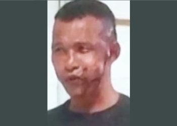 Homem joga soda cáustica no rosto da ex após mulher deixar delegacia