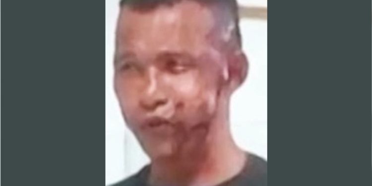 Homem joga soda cáustica no rosto da ex após mulher deixar delegacia